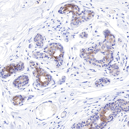 LIV-1/SLC39A6 Recombinant Rabbit mAb (SDT-206-84)
