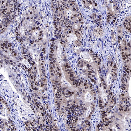 Phospho-NAK/TBK1 (Ser172) Recombinant Rabbit mAb (S-3182)
