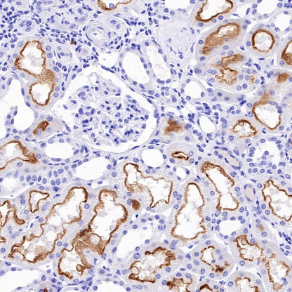 Villin Recombinant Rabbit mAb (SDT-R255)