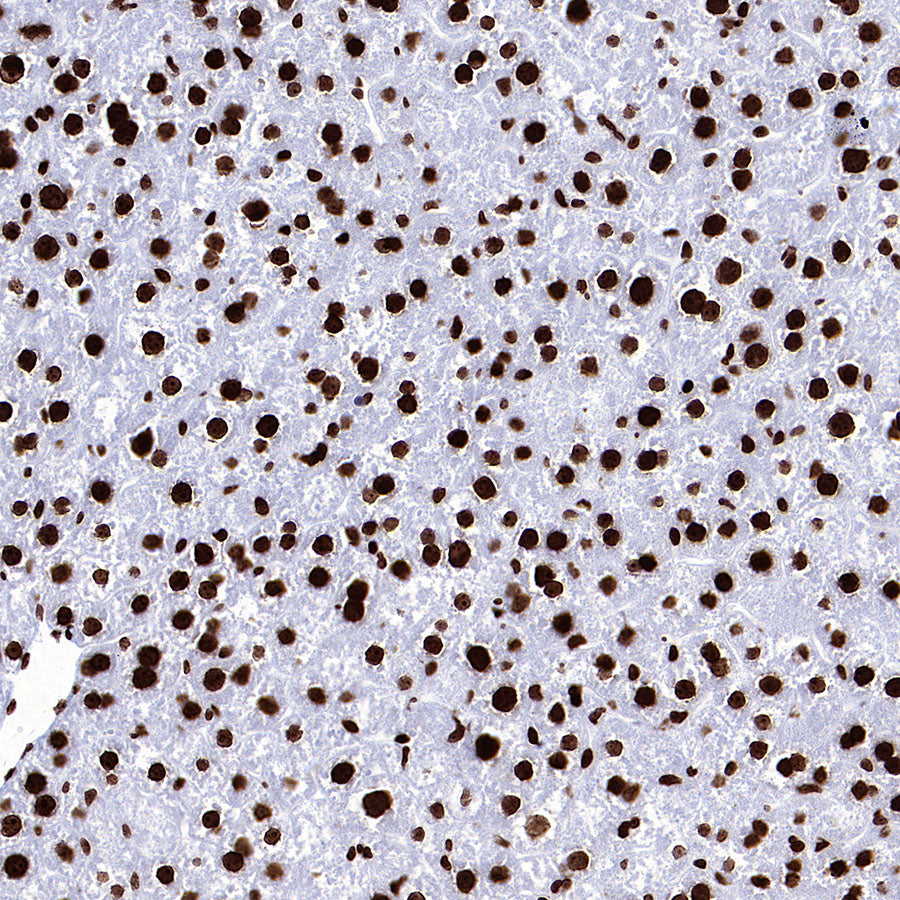 Histone H3 (tri methyl K27) Recombinant Rabbit mAb (S-4331)