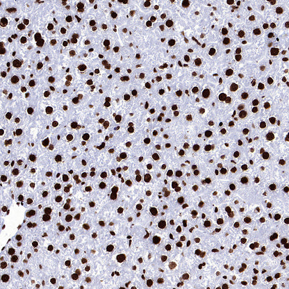 Histone H3 (tri methyl K27) Recombinant Rabbit mAb (S-4331)