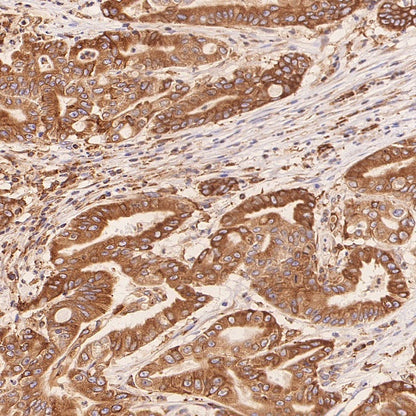 ERAP1 Recombinant Rabbit mAb (S-2509-38)