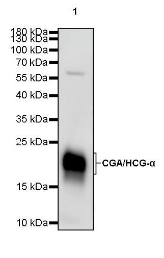 S-RMab® CGA/HCG-α Recombinant Rabbit mAb (SDT-643-61)