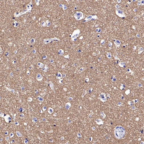FYN Recombinant Rabbit mAb (S-2157-52)