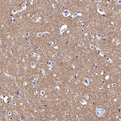 FYN Recombinant Rabbit mAb (S-2157-52)