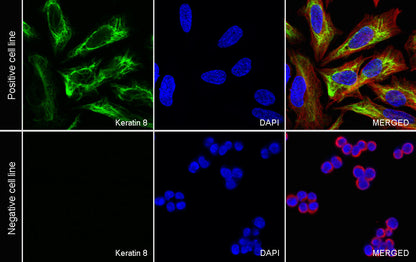 Keratin 8 Recombinant Rabbit mAb,PBS Only (SDT-016-46)