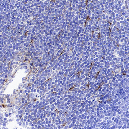 CCL21 Recombinant Rabbit mAb (S-3198-156)