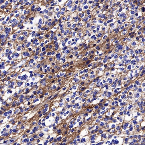 TrkB Recombinant Rabbit mAb (S-488-5)