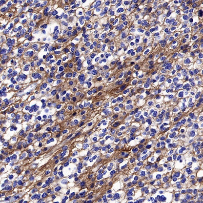 TrkB Recombinant Rabbit mAb (S-488-5)