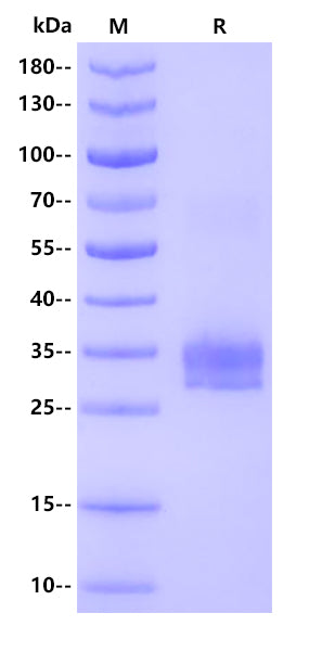Rat IgA Protein, His Tag