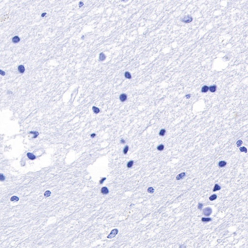 TPO Recombinant Rabbit mAb (SDT-420-57-1)