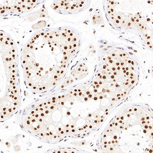NR1D1 + NR1D2 / RVR Recombinant Rabbit mAb (S-5962)