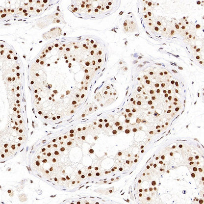 NR1D1 + NR1D2 / RVR Recombinant Rabbit mAb (S-5962)