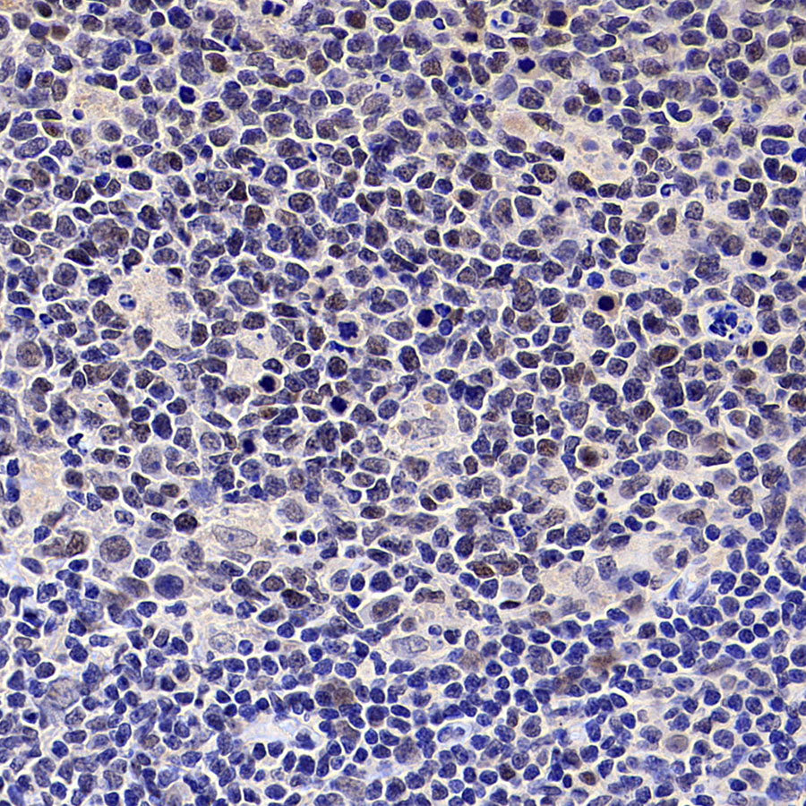 PAPSS1 Recombinant Rabbit mAb (S-3516-9)