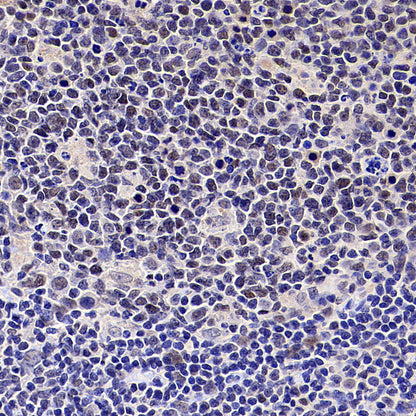 PAPSS1 Recombinant Rabbit mAb (S-3516-9)