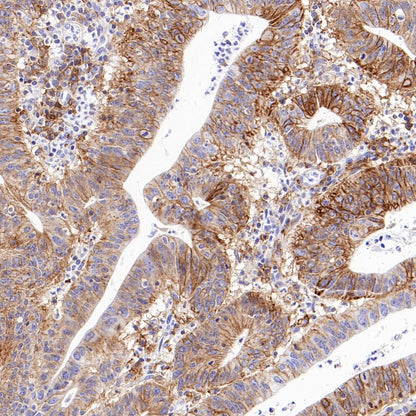 CD98/SLC3A2 Recombinant Rabbit mAb (SDT-2038-19)