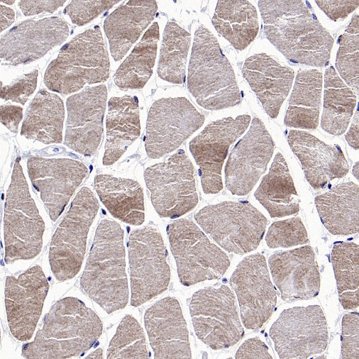 FACL4 Rabbit Polyclonal Antibody