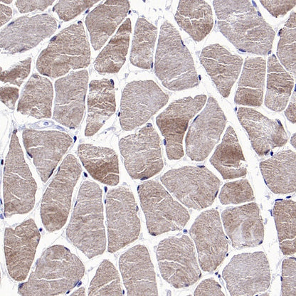 FACL4 Rabbit Polyclonal Antibody