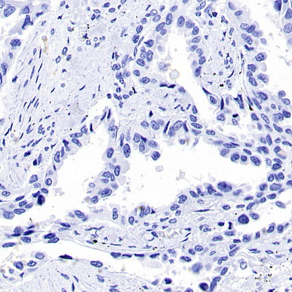 CK-13 Recombinant Rabbit mAb (SDT-R282)