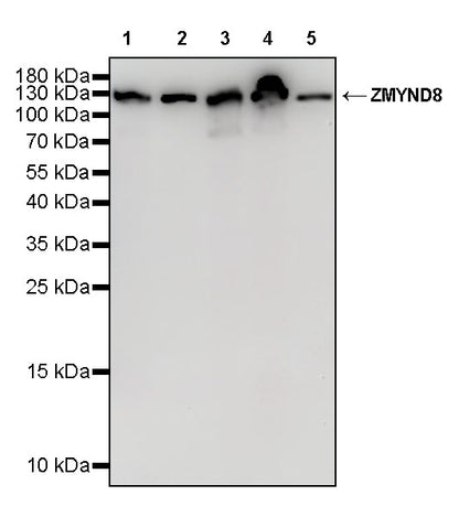 ZMYND8 Recombinant Rabbit mAb (S-5407)
