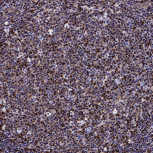 Stat5b Recombinant Rabbit mAb (S-2951-34)