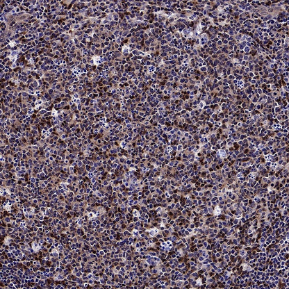 Stat5b Recombinant Rabbit mAb (S-2951-34)