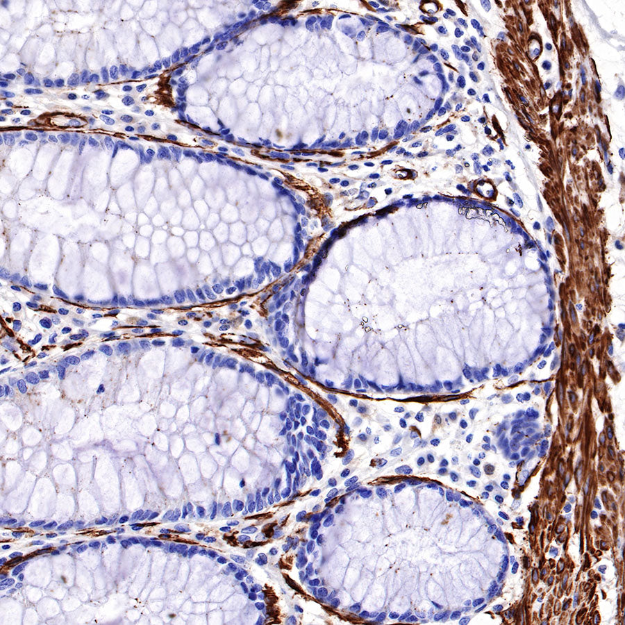 S-RMab® alpha smooth muscle Actin (SMA) Recombinant Rabbit mAb,PBS Only (SDT-301-142)