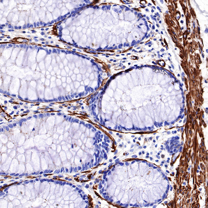 S-RMab® alpha smooth muscle Actin (SMA) Recombinant Rabbit mAb,PBS Only (SDT-301-142)