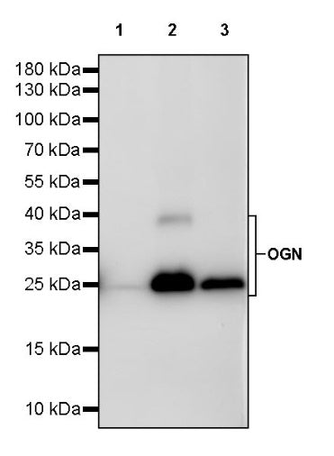 OGN Recombinant Rabbit mAb (S-245-327)