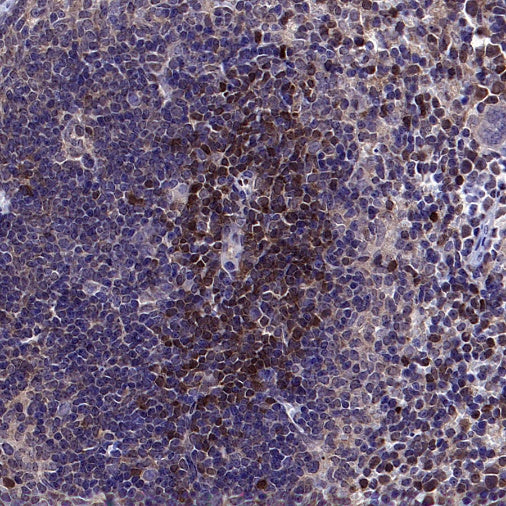 Stat5b Recombinant Rabbit mAb (S-2951-34)