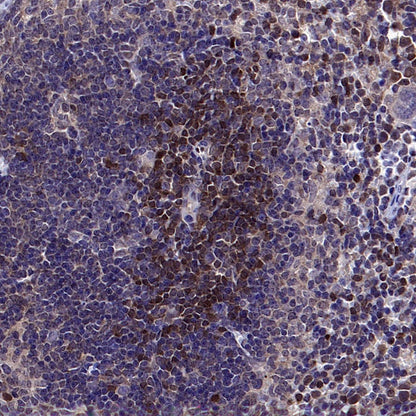 Stat5b Recombinant Rabbit mAb (S-2951-34)