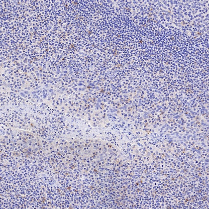 CD70 Recombinant Rabbit mAb (S-1725-277)