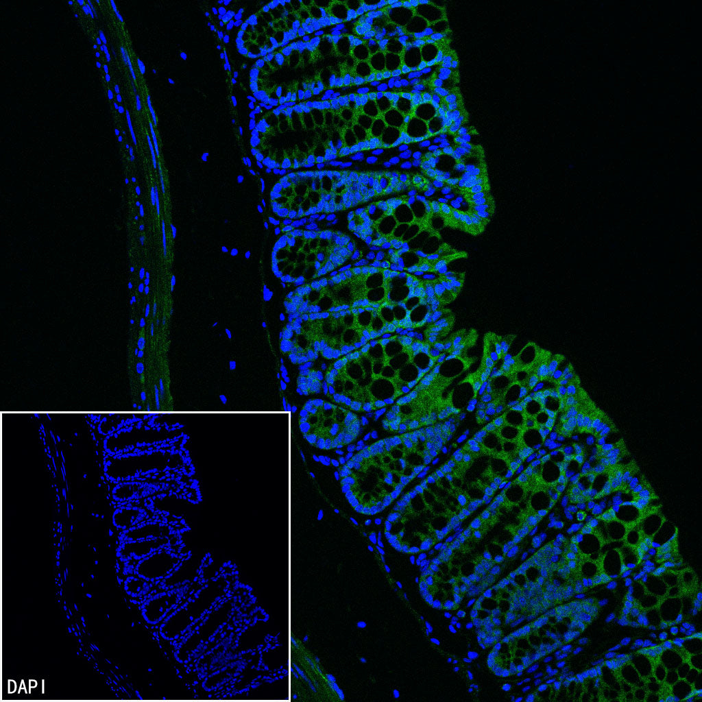 CHCHD10 Recombinant Rabbit mAb (S-4106-13)