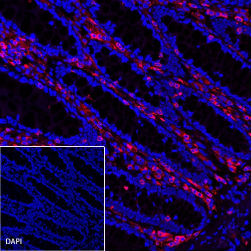 CD45 Recombinant Rabbit mAb (Alexa Fluor® 594 Conjugate) (S-R035)