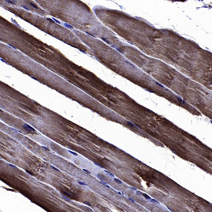 BIN1 Recombinant Rabbit mAb (S-4287-18)