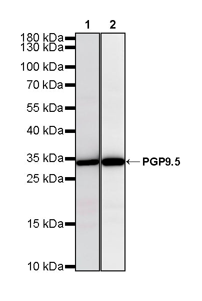 PGP9.5 Recombinant Mouse mAb (S-6071)