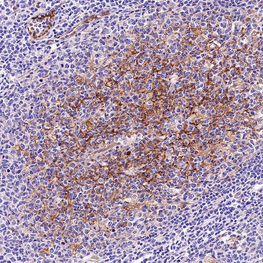 C4d Recombinant Rabbit mAb (SDT-330-2)