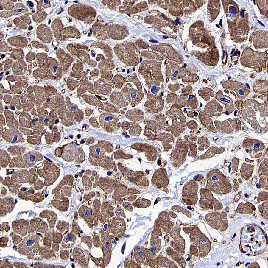 Vinculin Recombinant Rabbit mAb (S-5405)