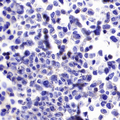 CDH17 Recombinant Rabbit mAb (SDT-3276-11)