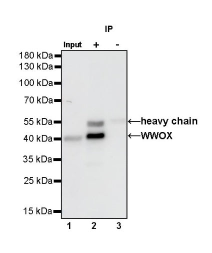 WWOX Recombinant Rabbit mAb (S-R298)