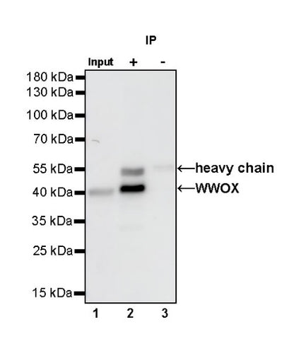 WWOX Recombinant Rabbit mAb (S-R298)
