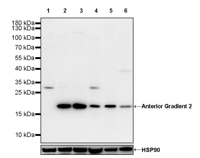 Anterior Gradient 2 Rabbit Polyclonal Antibody