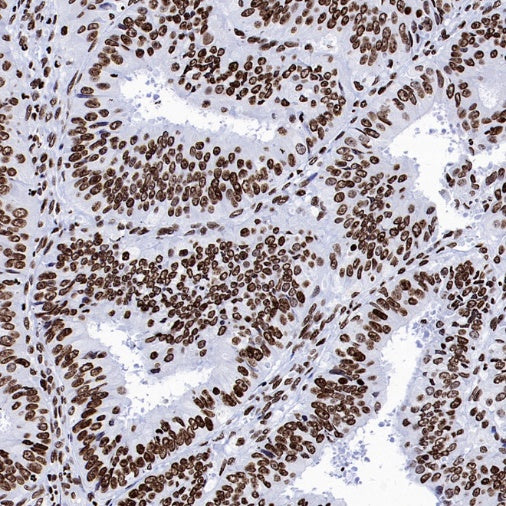 Histone H4 (Lactyl K8) Recombinant Rabbit mAb (S-3243-36)